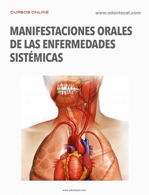 Portada del curso Manifestaciones Orales de las Enfermedades Sistémicas