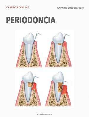 Portada del curso Periodoncia