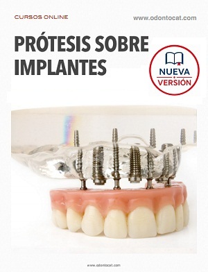 Curso de Prótesis sobre Implantes