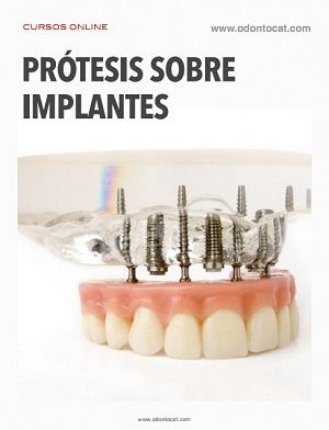 Portada del curso Prótesis sobre Implantes