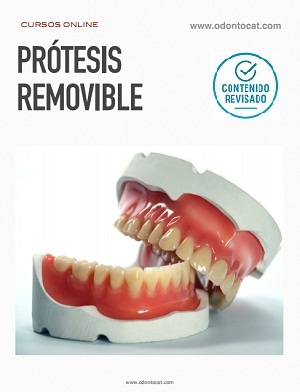 Curso de Prótesis Removible