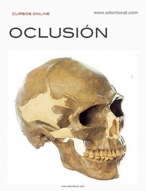 Portada del curso Oclusión